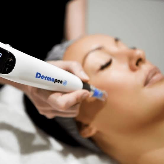 Microneedling