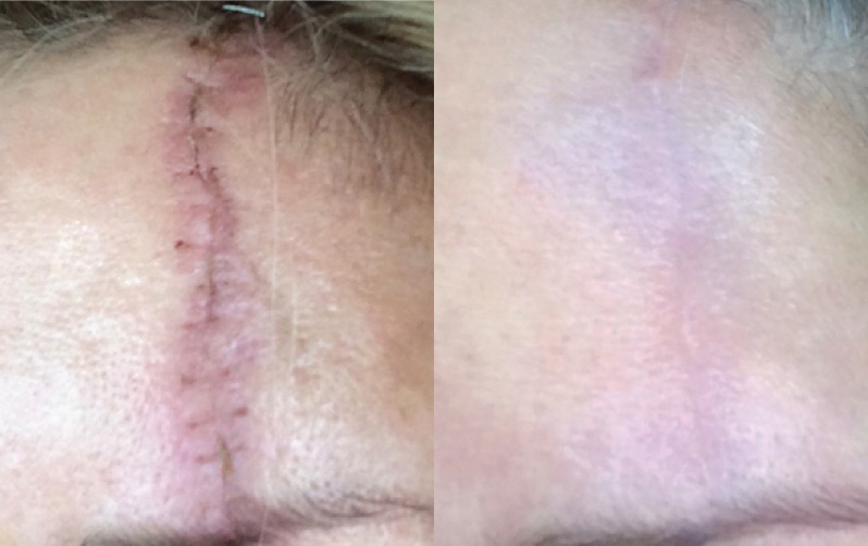 Viva 14