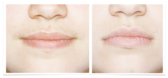 BA lip final