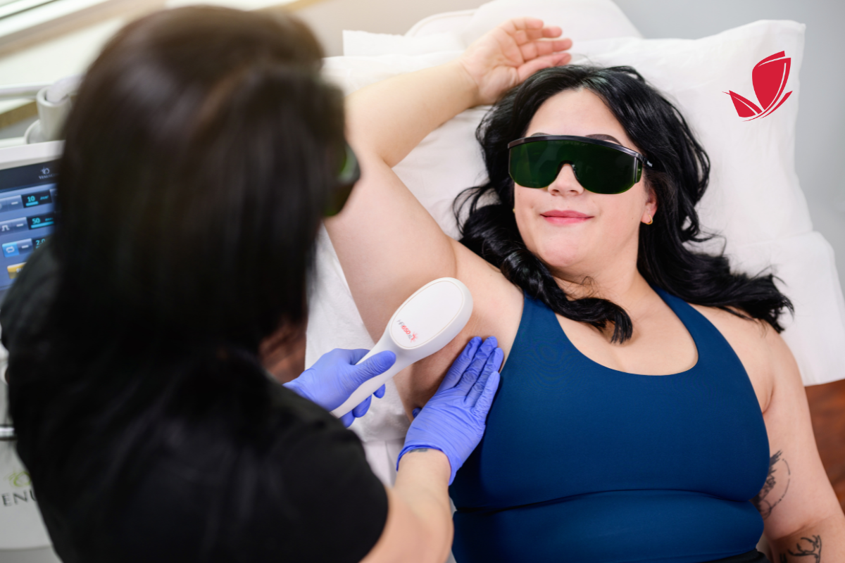5 Things to Know Before Getting Laser Hair Removal in Chicago