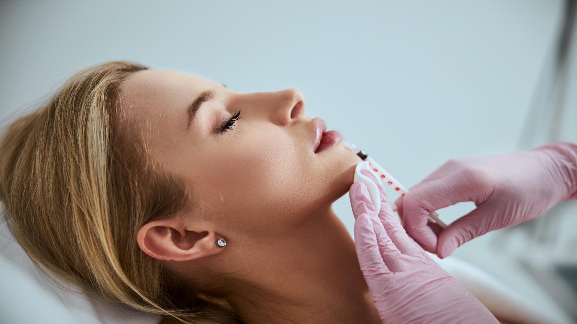 Dermal Filler
