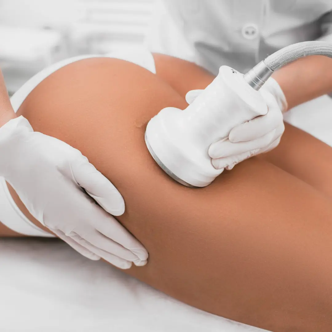 RF Skin Tightening