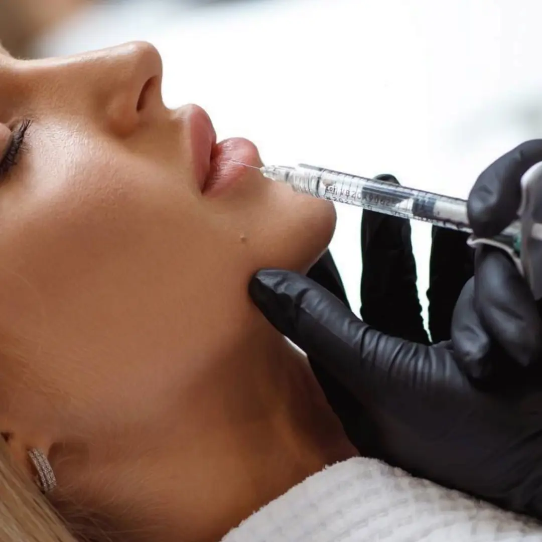 Dermal Fillers